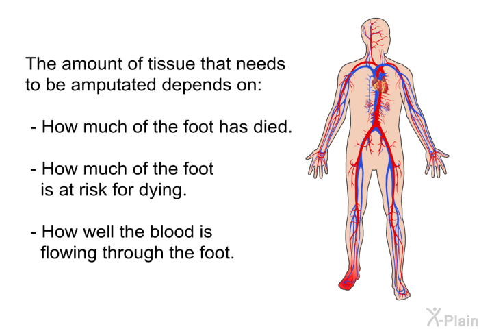 The amount of tissue that needs to be amputated depends on:  How much of the foot has died. How much of the foot is at risk for dying. How well the blood is flowing through the foot.
