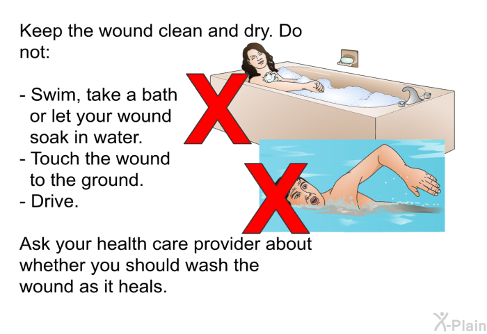 Keep the wound clean and dry. Do not:  Swim, take a bath or let your wound soak in water. Touch the wound to the ground. Drive.  
 Ask your health care provider about whether you should wash the wound as it heals.