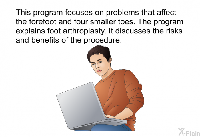 This health information focuses on problems that affect the forefoot and four smaller toes. The information explains foot arthroplasty. It discusses the risks and benefits of the procedure.