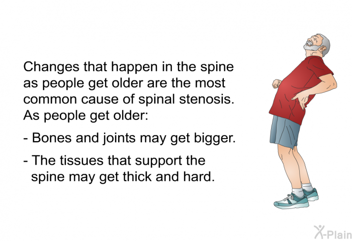 Changes that happen in the spine as people get older are the most common cause of spinal stenosis. As people get older:  Bones and joints may get bigger. The tissues that support the spine may get thick and hard.