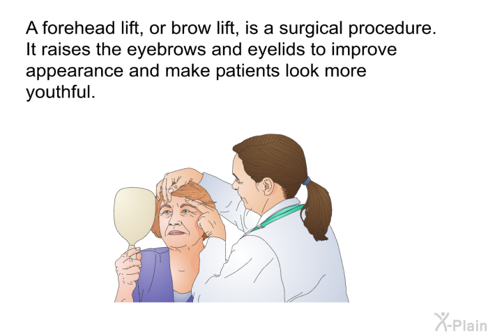 A forehead lift, or brow lift, is a surgical procedure. It raises the eyebrows and eyelids to improve appearance and make patients look more youthful.