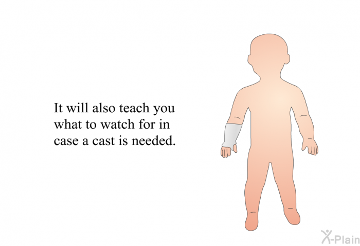 It will also teach you what to watch for in case a cast is needed.