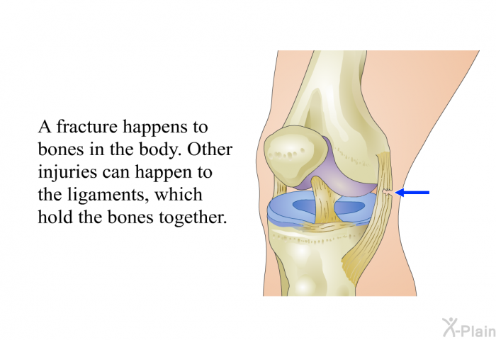 A fracture happens to bones in the body. Other injuries can happen to the ligaments, which hold the bones together.