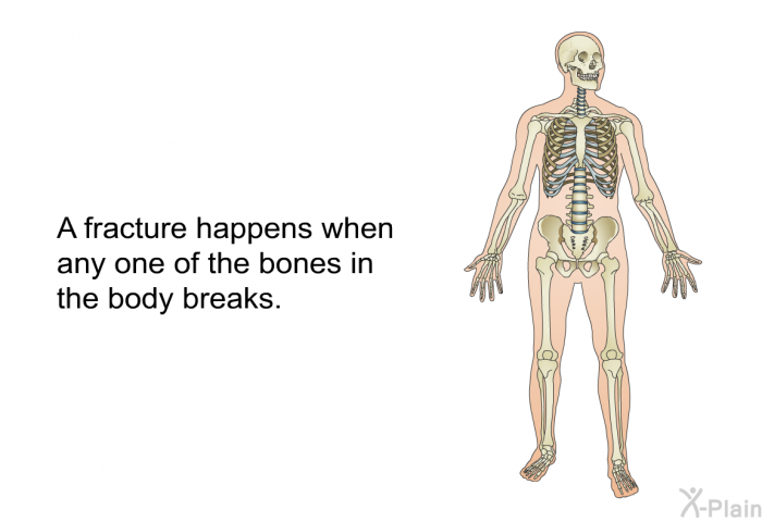 A fracture happens when any one of the bones in the body breaks.