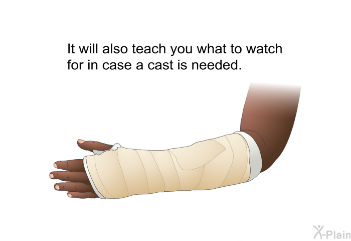 It will also teach you what to watch for in case a cast is needed.