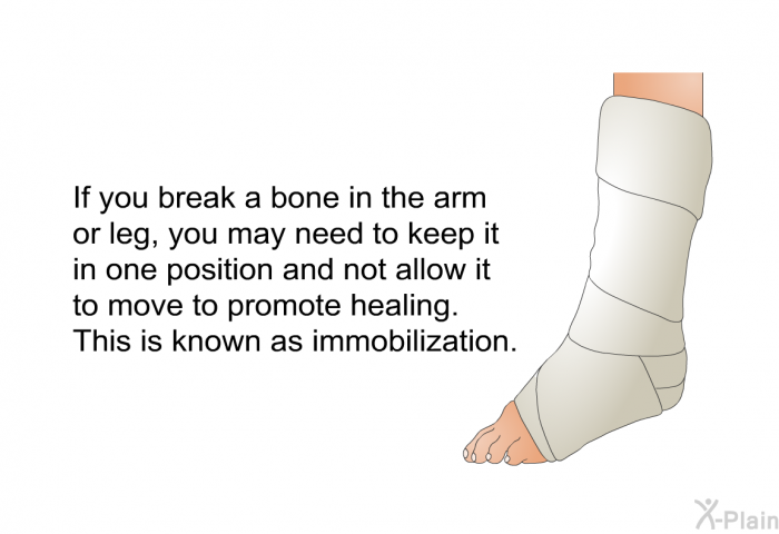 If you break a bone in the arm or leg, you may need to keep it in one position and not allow it to move to promote healing. This is known as immobilization.
