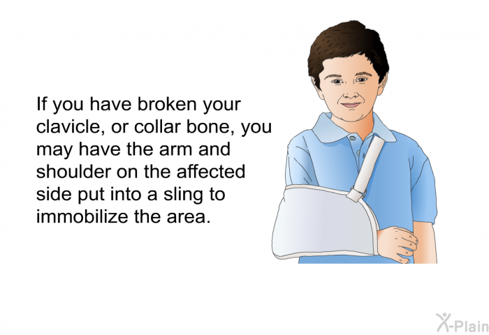 If you have broken your clavicle, or collar bone, you may have the arm and shoulder on the affected side put into a sling to immobilize the area.