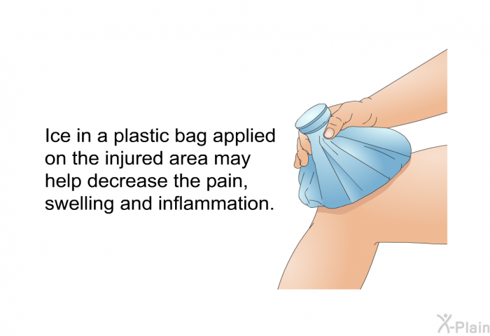 Ice in a plastic bag applied on the injured area may help decrease the pain, swelling and inflammation.
