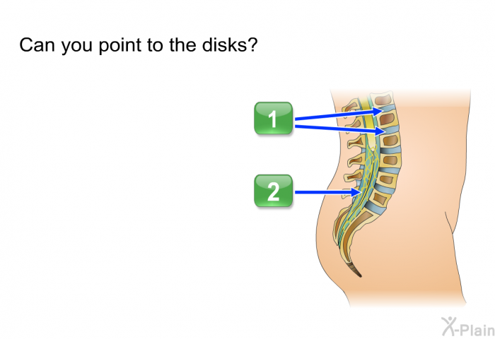 Can you point to the disks?