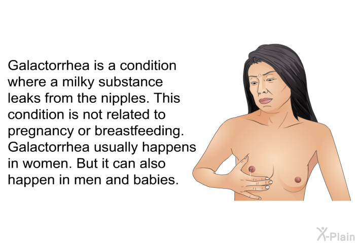 Galactorrhea is a condition where a milky substance leaks from the nipples. This condition is not related to pregnancy or breastfeeding. Galactorrhea usually happens in women. But it can also happen in men and babies.
