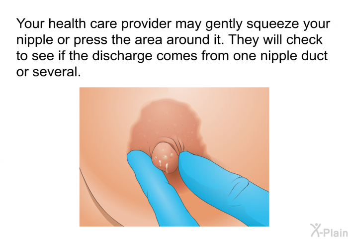 Your health care provider may gently squeeze your nipple or press the area around it. They will check to see if the discharge comes from one nipple duct or several.