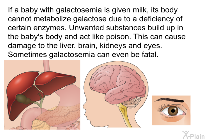 If a baby with galactosemia is given milk, its body cannot metabolize galactose due to a deficiency of certain enzymes. Unwanted substances build up in the baby's body and act like poison. This can cause damage to the liver, brain, kidneys and eyes. Sometimes galactosemia can even be fatal.