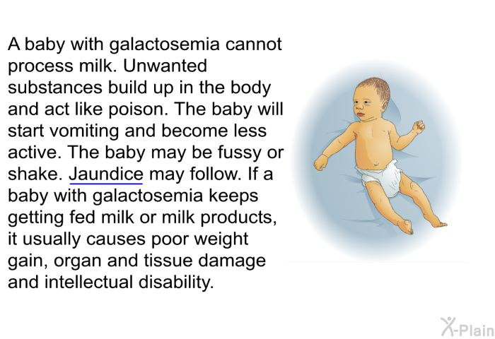 A baby with galactosemia cannot process milk. Unwanted substances build up in the body and act like poison. The baby will start vomiting and become less active. The baby may be fussy or shake. Jaundice may follow. If a baby with galactosemia keeps getting fed milk or milk products, it usually causes poor weight gain, organ and tissue damage and intellectual disability.