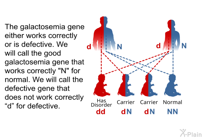 The galactosemia gene either works correctly or is defective. We will call the good galactosemia gene that works correctly “N” for normal. We will call the defective gene that does not work correctly “d” for defective.