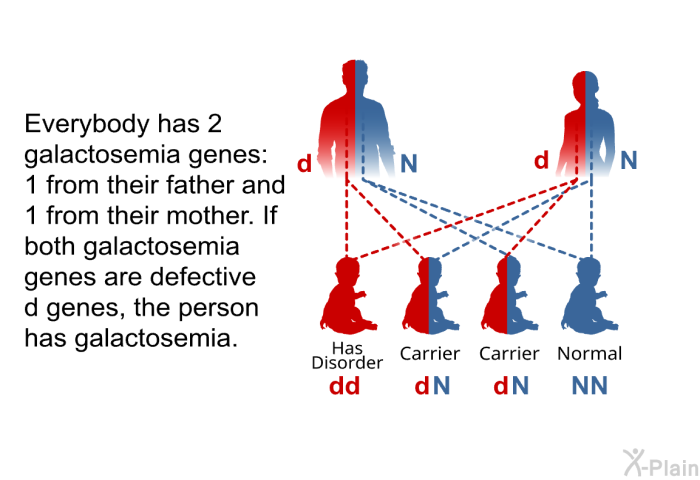 Everybody has 2 galactosemia genes: 1 from their father and 1 from their mother. If both galactosemia genes are defective d genes, the person has galactosemia.