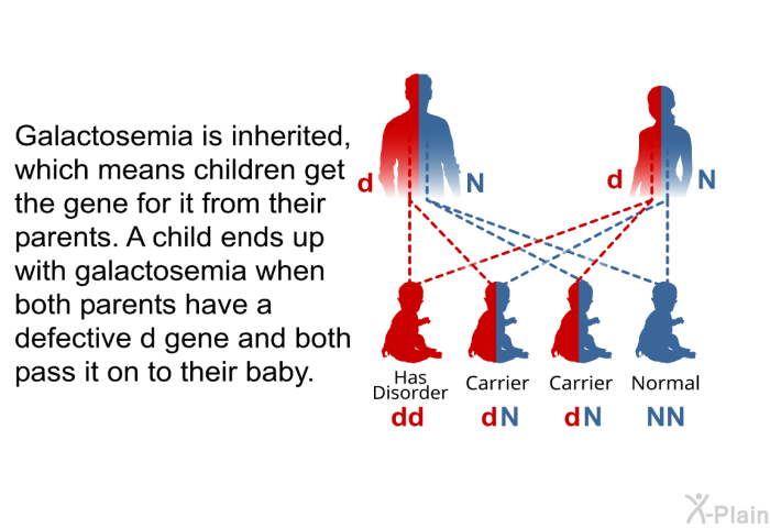Galactosemia is inherited, which means children get the gene for it from their parents. A child ends up with galactosemia when both parents have a defective d gene and both pass it on to their baby.