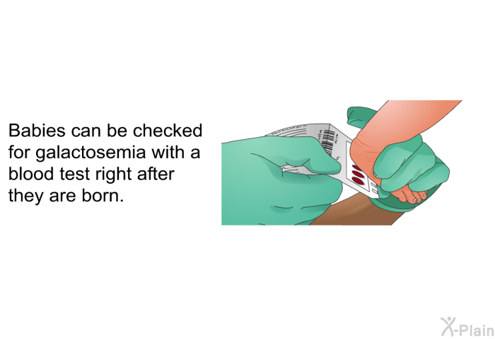 Babies can be checked for galactosemia with a blood test right after they are born.