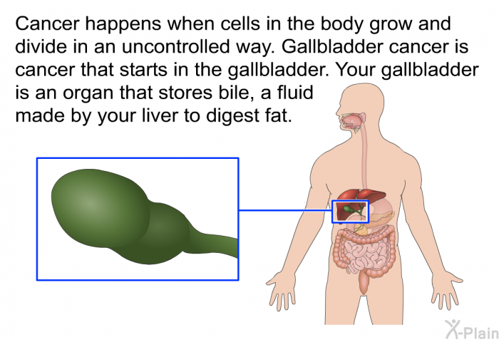 Cancer happens when cells in the body grow and divide in an uncontrolled way. Gallbladder cancer is cancer that starts in the gallbladder. Your gallbladder is an organ that stores bile, a fluid made by your liver to digest fat.