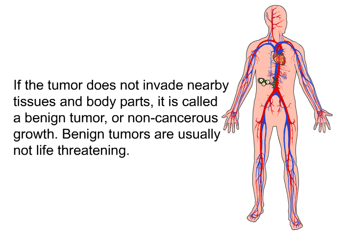 If the tumor does not invade nearby tissues and body parts, it is called a benign tumor, or non-cancerous growth. Benign tumors are usually not life threatening.
