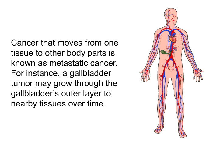 PatEdu Gallbladder Cancer