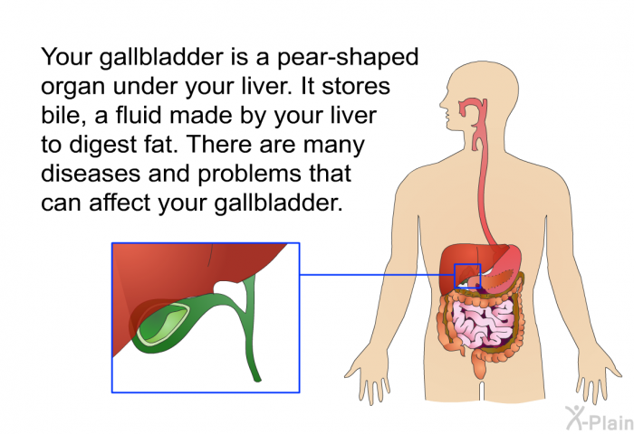 Your gallbladder is a pear-shaped organ under your liver. It stores bile, a fluid made by your liver to digest fat. There are many diseases and problems that can affect your gallbladder.