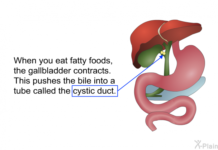 When you eat fatty foods, the gallbladder contracts. This pushes the bile into a tube called the cystic duct.