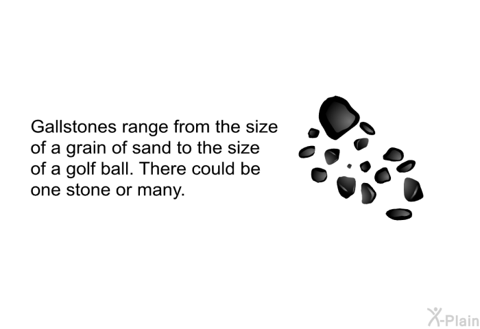Gallstones range from the size of a grain of sand to the size of a golf ball. There could be one stone or many.