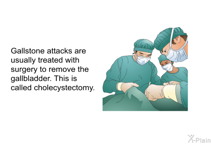 Gallstone attacks are usually treated with surgery to remove the gallbladder. This is called cholecystectomy.