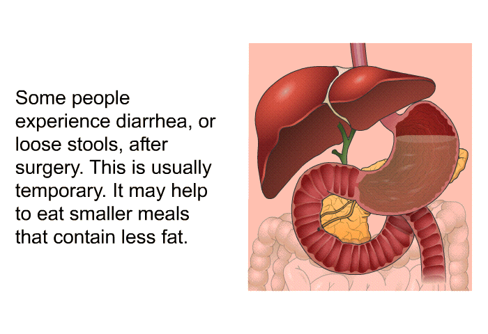 Some people experience diarrhea, or loose stools, after surgery. This is usually temporary. It may help to eat smaller meals that contain less fat.
