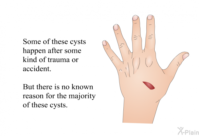 Some of these cysts happen after some kind of trauma or accident. But there is no known reason for the majority of these cysts.