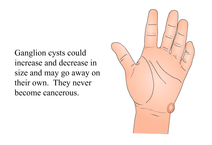 Ganglion cysts could increase and decrease in size and may go away on their own. They never become cancerous.
