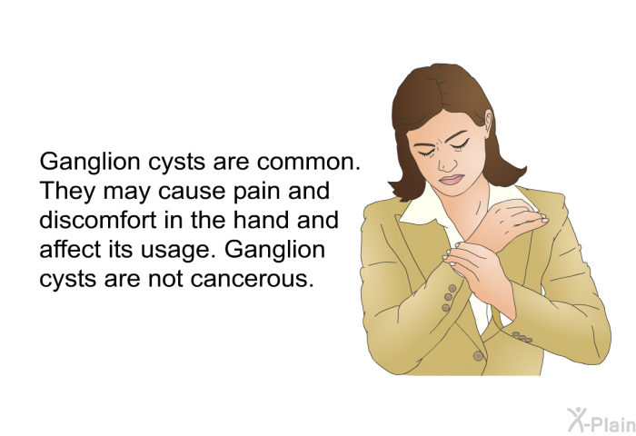 Ganglion cysts are common. They may cause pain and discomfort in the hand and affect its usage. Ganglion cysts are not cancerous.
