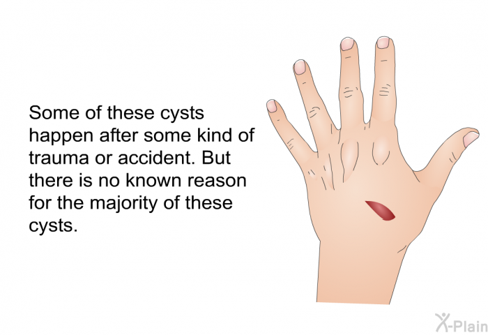 Some of these cysts happen after some kind of trauma or accident. But there is no known reason for the majority of these cysts.