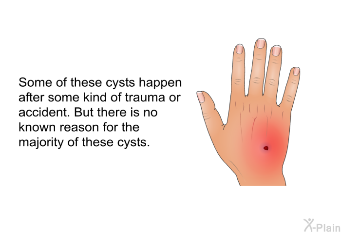 Some of these cysts happen after some kind of trauma or accident. But there is no known reason for the majority of these cysts.