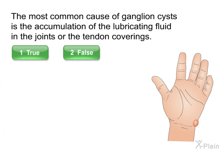 The most common cause of ganglion cysts is the accumulation of the lubricating fluid in the joints or the tendon coverings.