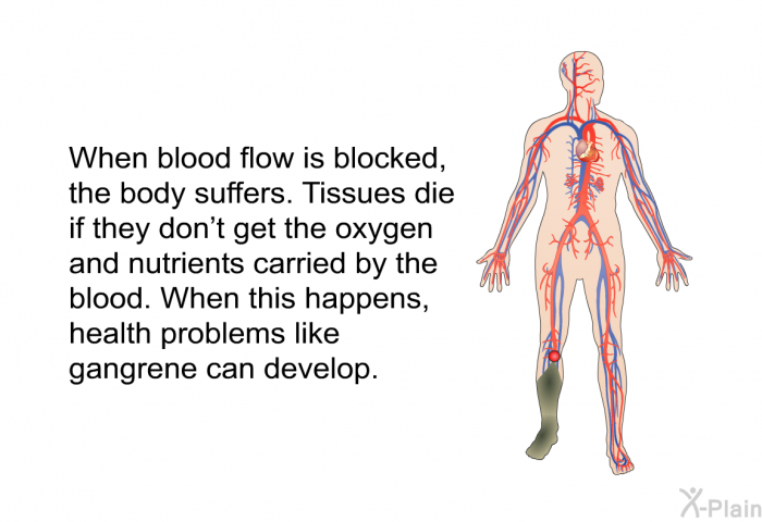 When blood flow is blocked, the body suffers. Tissues die if they don't get the oxygen and nutrients carried by the blood. When this happens, health problems like gangrene can develop.