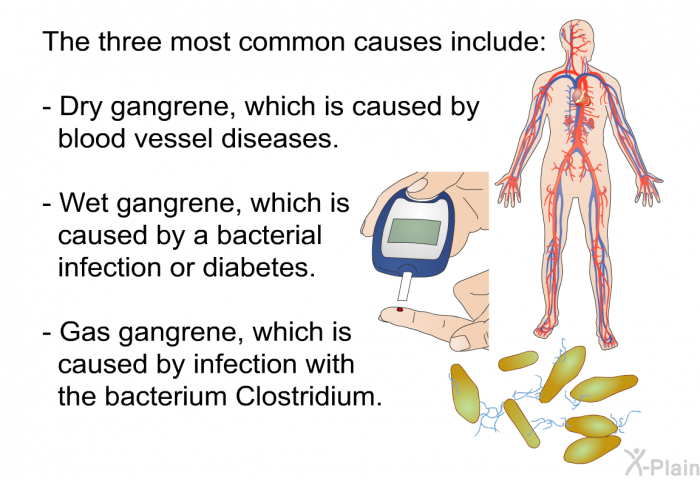 The three most common causes include:  Dry gangrene, which is caused by blood vessel diseases. Wet gangrene, which is caused by a bacterial infection or diabetes. Gas gangrene, which is caused by infection with the bacterium Clostridium.