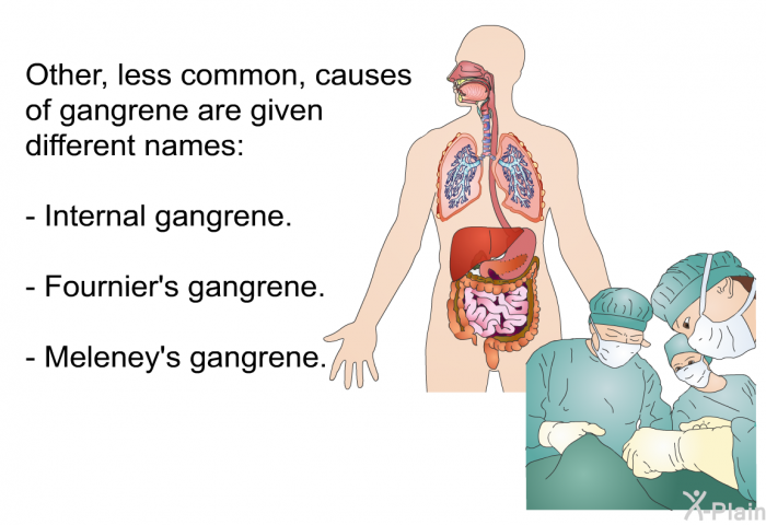 Other, less common, causes of gangrene are given different names:  Internal gangrene. Fournier's gangrene. Meleney's gangrene.