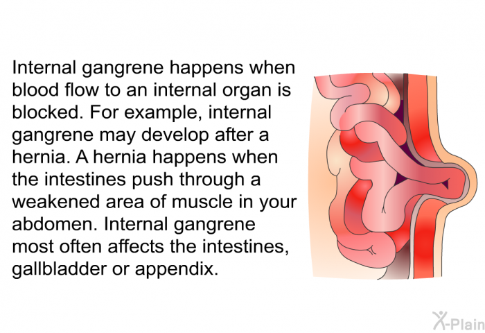 Internal gangrene happens when blood flow to an internal organ is blocked. For example, internal gangrene may develop after a hernia. A hernia happens when the intestines push through a weakened area of muscle in your abdomen. Internal gangrene most often affects the intestines, gallbladder or appendix.