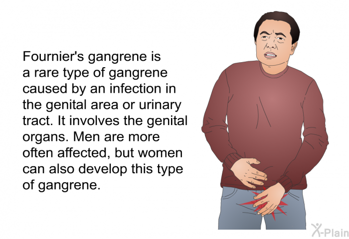 Fournier's gangrene is a rare type of gangrene caused by an infection in the genital area or urinary tract. It involves the genital organs. Men are more often affected, but women can also develop this type of gangrene.