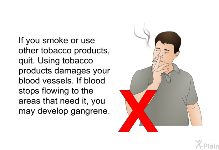 If you smoke or use other tobacco products, quit. Using tobacco products damages your blood vessels. If blood stops flowing to the areas that need it, you may develop gangrene.