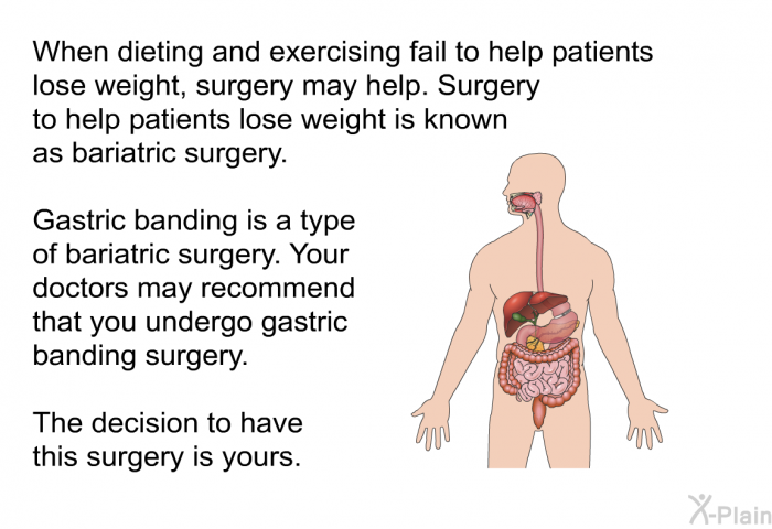 When dieting and exercising fail to help patients lose weight, surgery may help. Surgery to help patients lose weight is known as bariatric surgery. Gastric banding is a type of bariatric surgery. Your doctors may recommend that you undergo gastric banding surgery. The decision to have this surgery is yours.