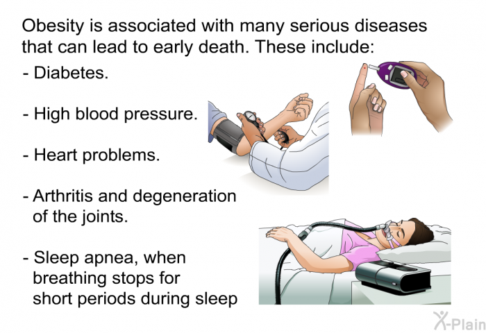 Obesity is associated with many serious diseases that can lead to early death. These include:  Diabetes. High blood pressure. Heart problems. Arthritis and degeneration of the joints. Sleep apnea, when breathing stops for short periods during sleep.