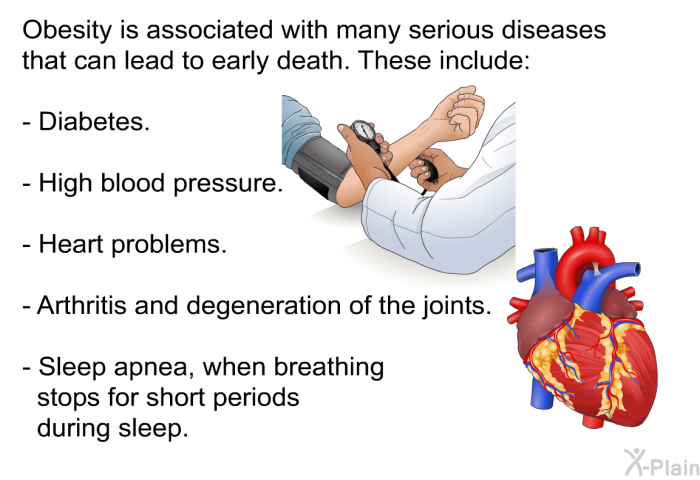 Obesity is associated with many serious diseases that can lead to early death. These include:  Diabetes. High blood pressure. Heart problems. Arthritis and degeneration of the joints. Sleep apnea, when breathing stops for short periods during sleep.