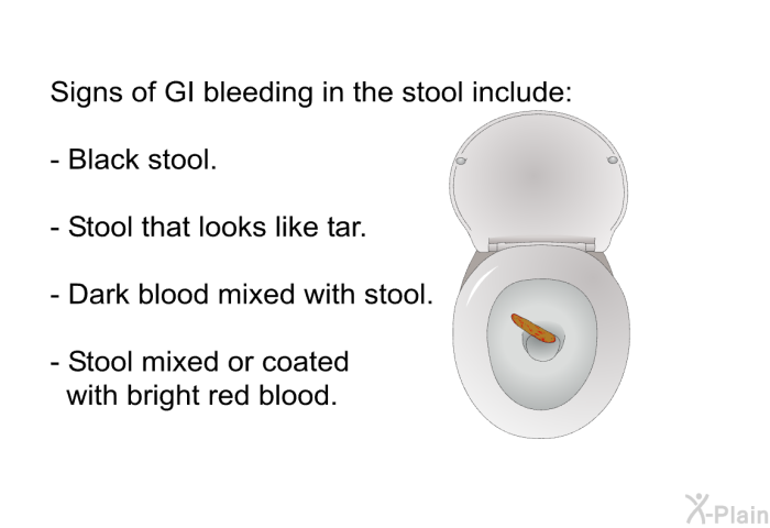 Signs of GI bleeding in the stool include:  Black stool. Stool that looks like tar. Dark blood mixed with stool. Stool mixed or coated with bright red blood.