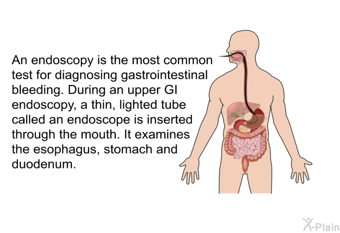 An endoscopy is the most common test for diagnosing gastrointestinal bleeding. During an upper GI endoscopy, a thin, lighted tube called an endoscope is inserted through the mouth. It examines the esophagus, stomach and duodenum.