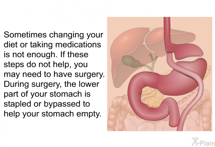 Sometimes changing your diet or taking medications is not enough. If these steps do not help, you may need to have surgery. During surgery, the lower part of your stomach is stapled or bypassed to help your stomach empty.