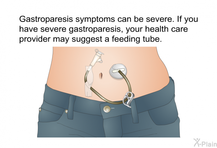 Gastroparesis symptoms can be severe. If you have severe gastroparesis, your health care provider may suggest a feeding tube.