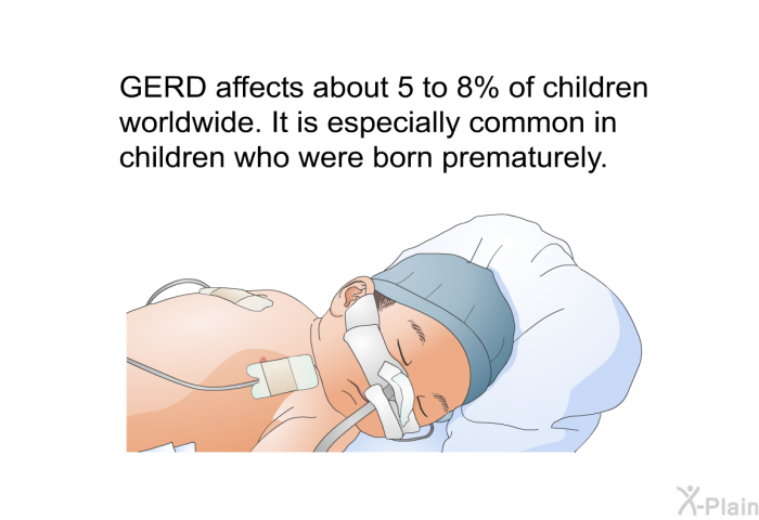 GERD affects about 5 to 8% of children worldwide. It is especially common in children who were born prematurely.