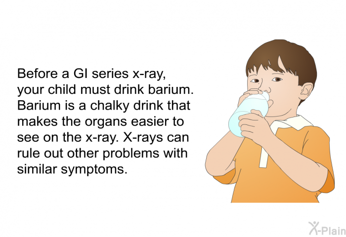Before a GI series x-ray, your child must drink barium. Barium is a chalky drink that makes the organs easier to see on the x-ray. X-rays can rule out other problems with similar symptoms.
